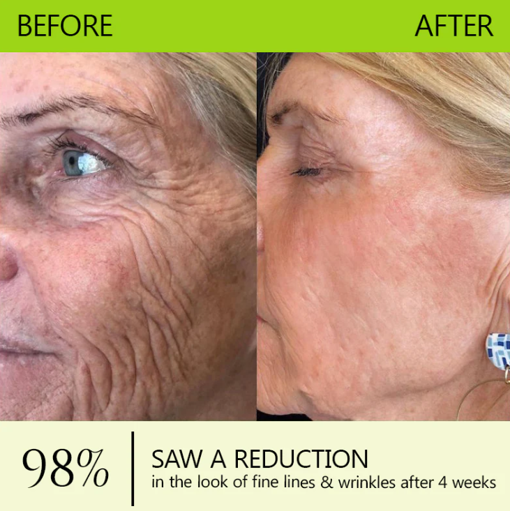 Leanbotanica™ Lifting & Firming Cream – Advanced Retinol & Peptide Care for Wrinkles, Sagging Skin & Puffy Eyes