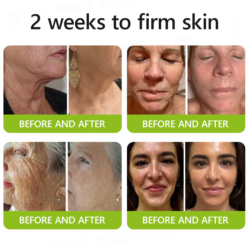 Leanbotanica™ Lifting & Firming Cream – Advanced Retinol & Peptide Care for Wrinkles, Sagging Skin & Puffy Eyes