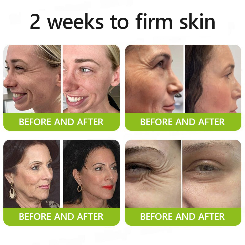 Leanbotanica™ Lifting & Firming Cream – Advanced Retinol & Peptide Care for Wrinkles, Sagging Skin & Puffy Eyes