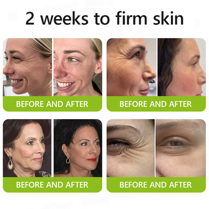 Leanbotanica™ Lifting & Firming Cream – Advanced Retinol & Peptide Care for Wrinkles, Sagging Skin & Puffy Eyes