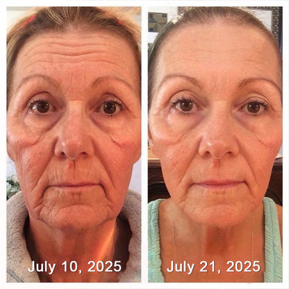 Leanbotanica™ Lifting & Firming Cream – Advanced Retinol & Peptide Care for Wrinkles, Sagging Skin & Puffy Eyes