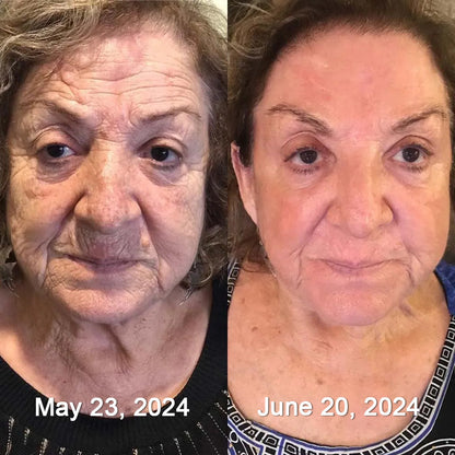 Leanbotanica™ Lifting & Firming Cream – Advanced Retinol & Peptide Care for Wrinkles, Sagging Skin & Puffy Eyes