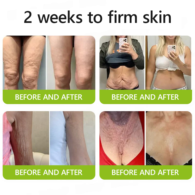 Leanbotanica™ Lifting & Firming Cream – Advanced Retinol & Peptide Care for Wrinkles, Sagging Skin & Puffy Eyes