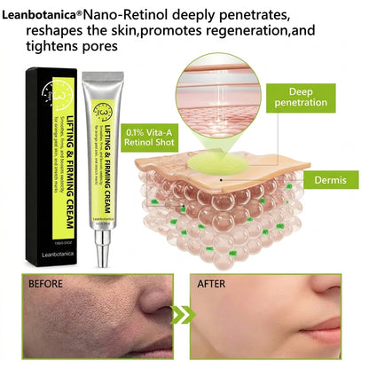 Leanbotanica™ Lifting & Firming Cream – Advanced Retinol & Peptide Care for Wrinkles, Sagging Skin & Puffy Eyes